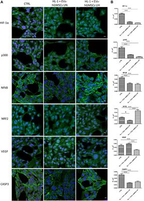 Protective effect of oral stem cells extracellular vesicles on cardiomyocytes in hypoxia-reperfusion